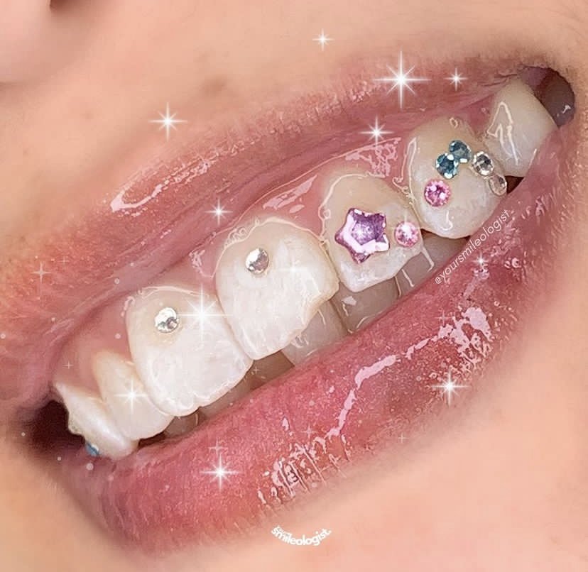 Real tooth gems — colourful crystals with sparkle