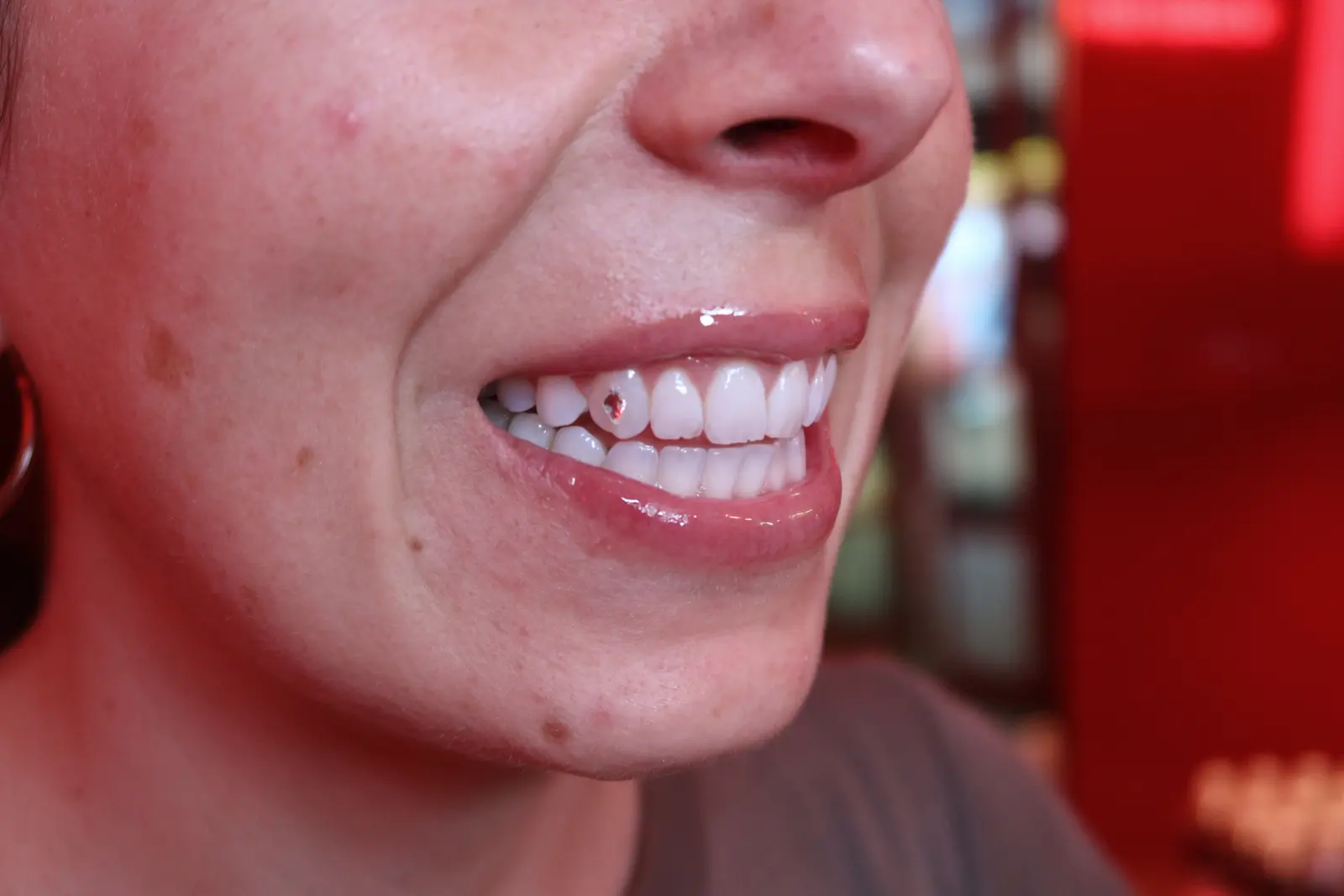 Macro shot of a single gem on a front tooth