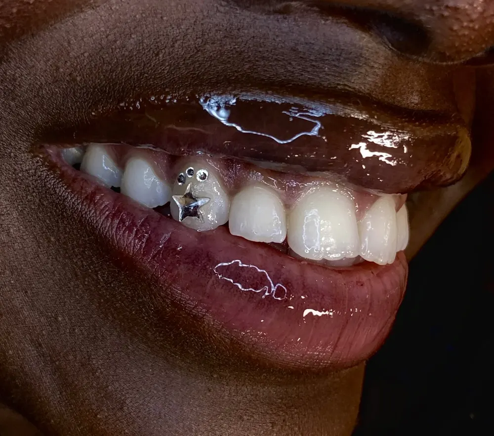 Tooth gem placement by Nhi, client work 3