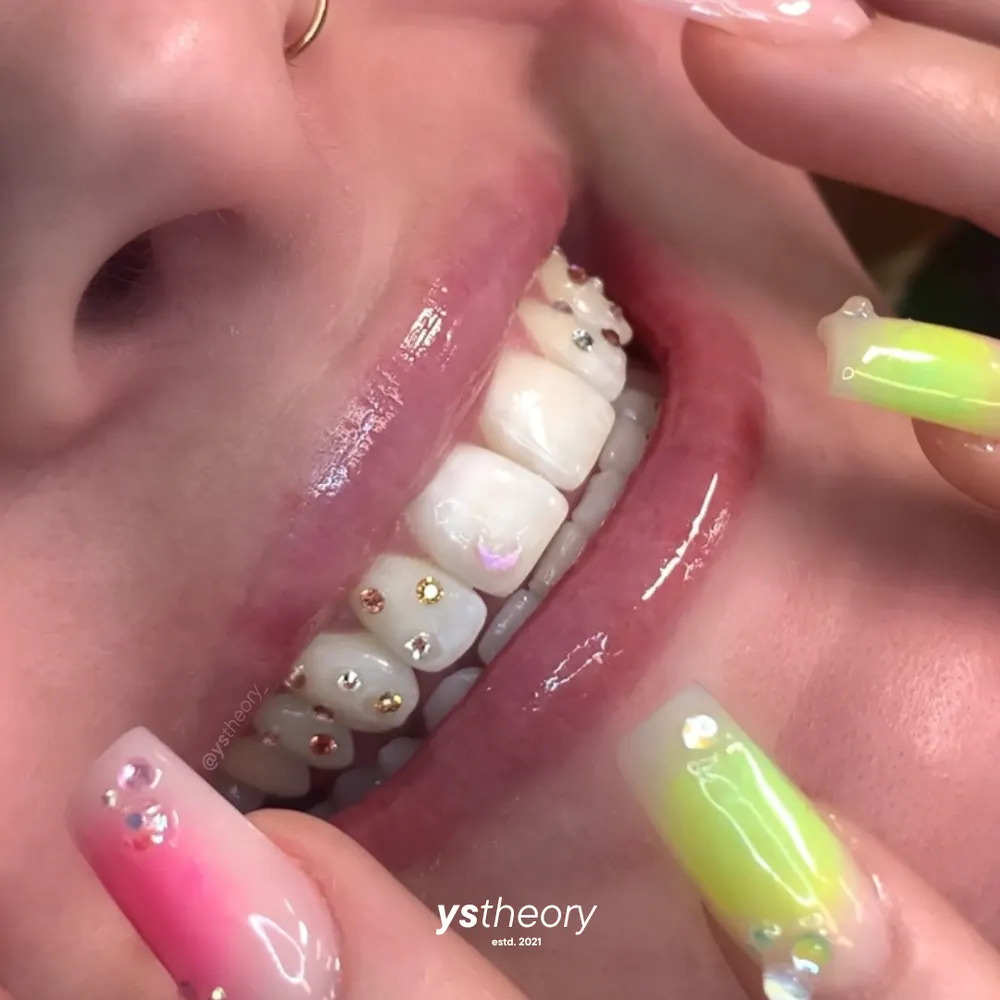 Tooth gem placement by Nhi, client work 5