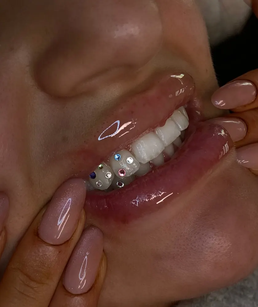 Tooth gem placement by Nhi, client work 7