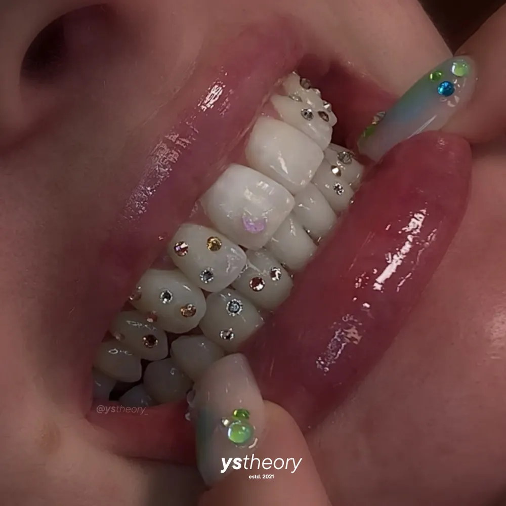 Tooth gem placement by Nhi, client work 9