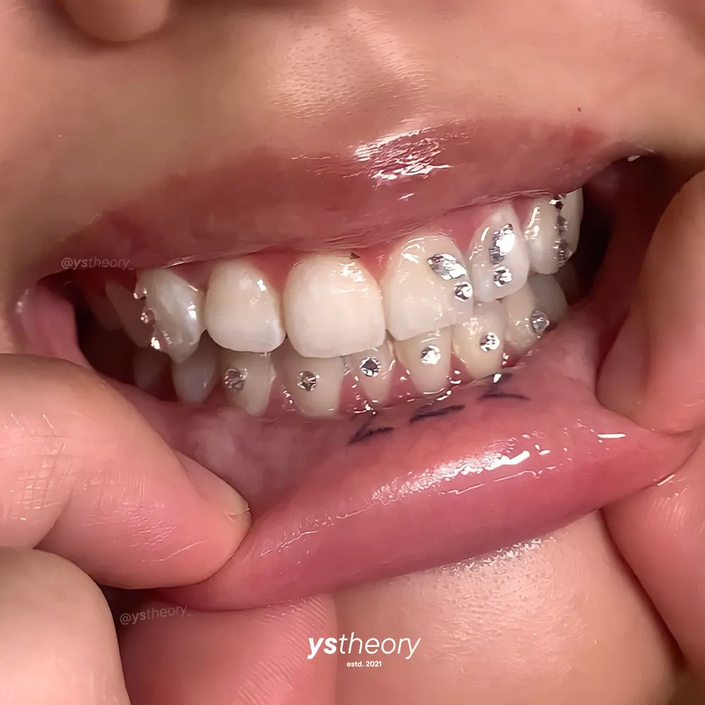 Tooth gem placement by Nhi, client work 10