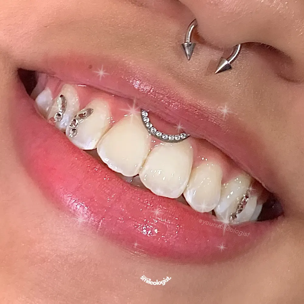 Tooth gem placement by Nhi, client work 16