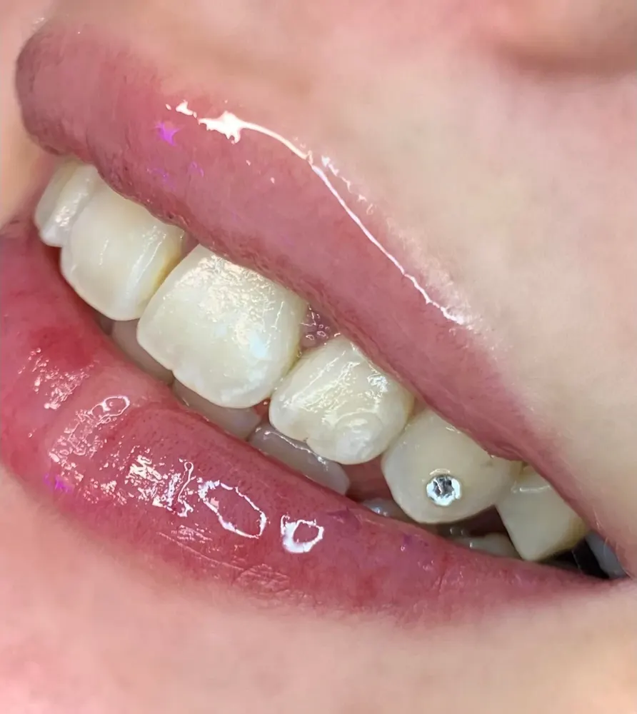 Tooth gem placement by Nhi, client work 17