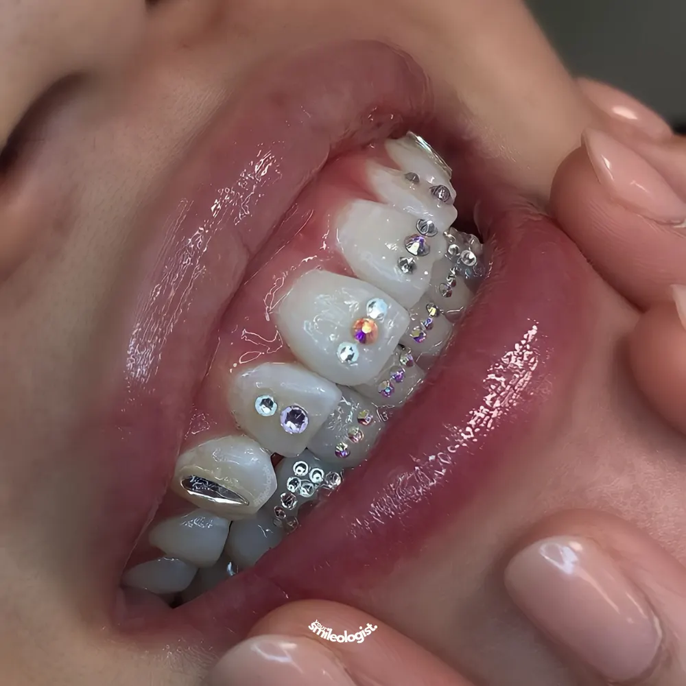 Tooth gem placement by Nhi, client work 18