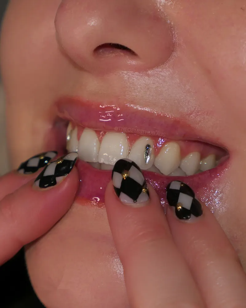Tooth gem placement by Nhi, client work 19