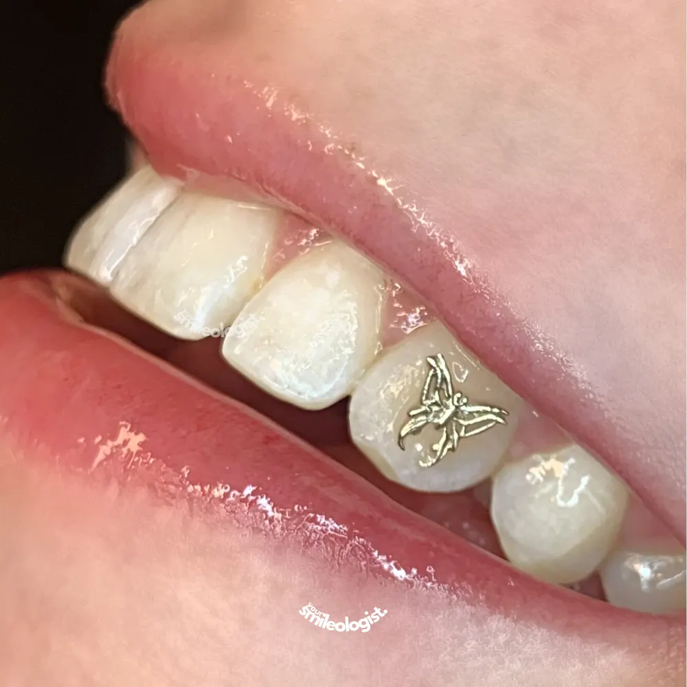 Tooth gem placement by Nhi, client work 20