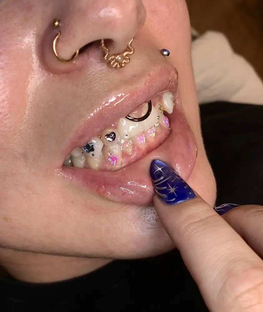 Tooth gem placement by Nhi, client work 23