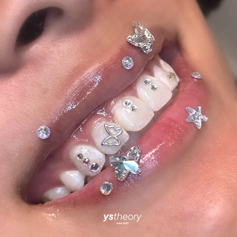 Tooth gem placement by Nhi, client work 25