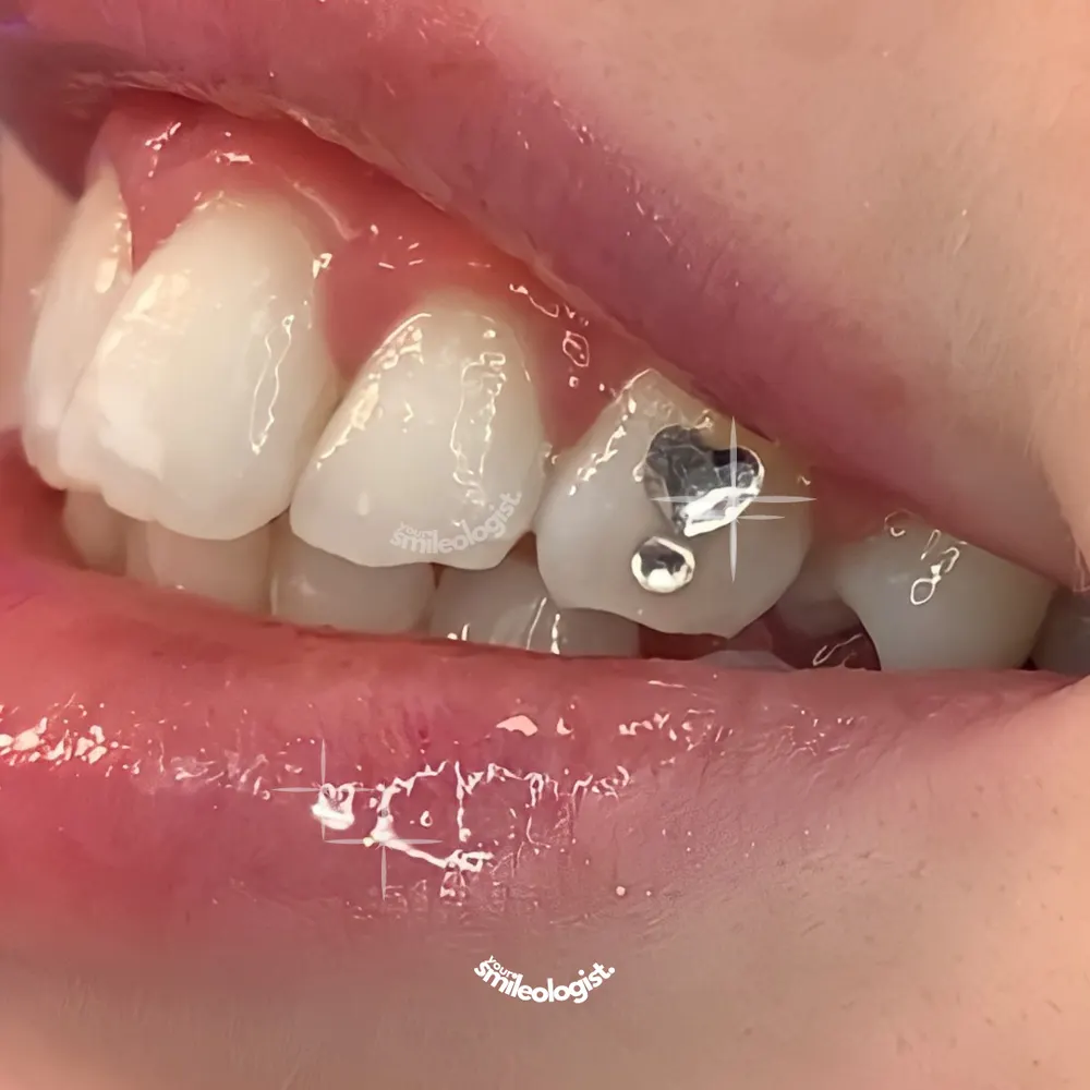 Tooth gem placement by Nhi, client work 28