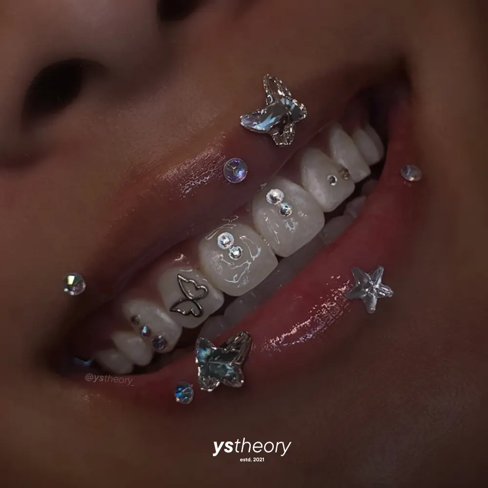 Tooth gem placement by Nhi, client work 31