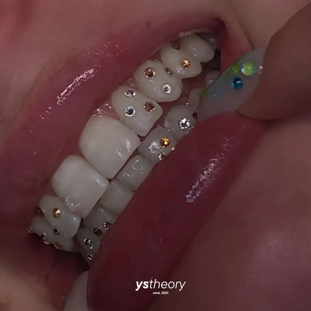 Tooth gem placement by Nhi, client work 33