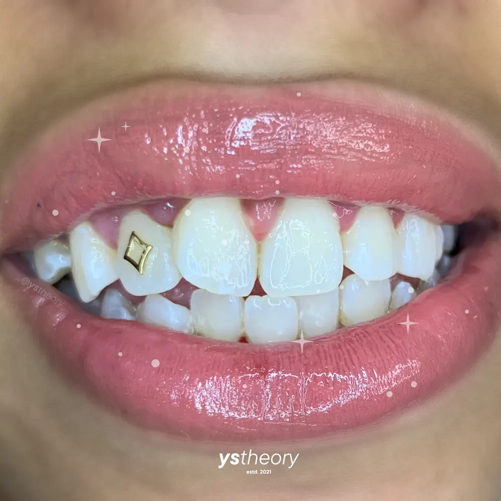 Tooth gem placement by Nhi, client work 35