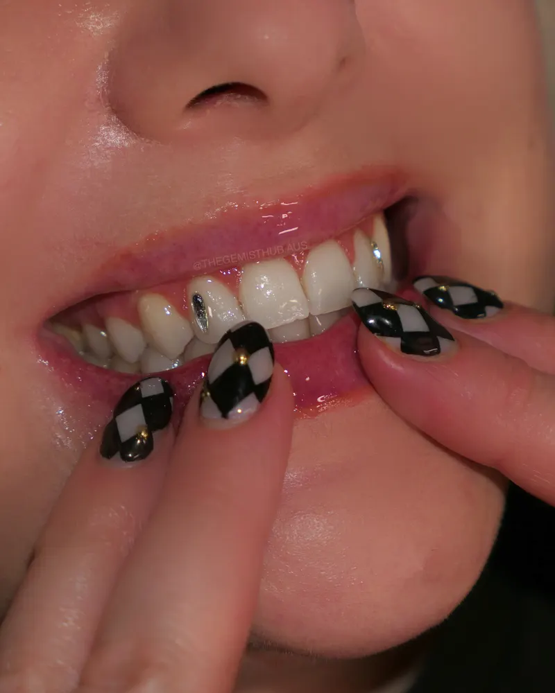 Tooth gem placement by Nhi, client work 36