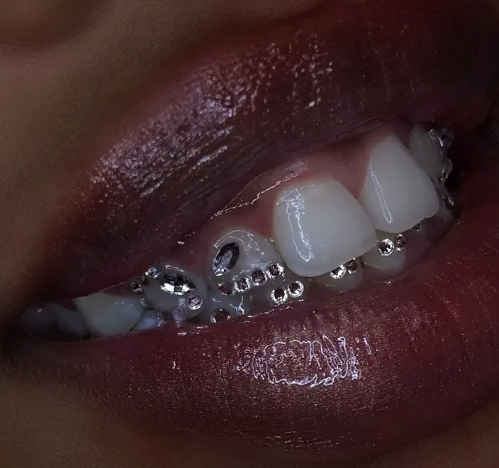 Macro photograph of a gem cluster on a tooth.