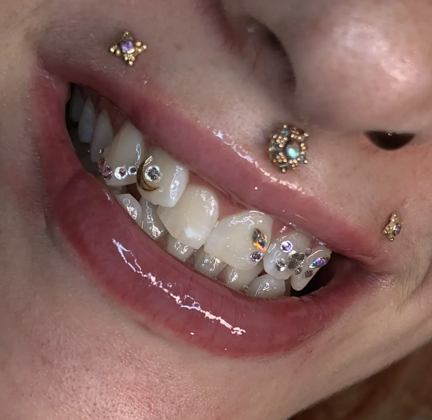 A finished tooth-gem placement photographed close to the smile.