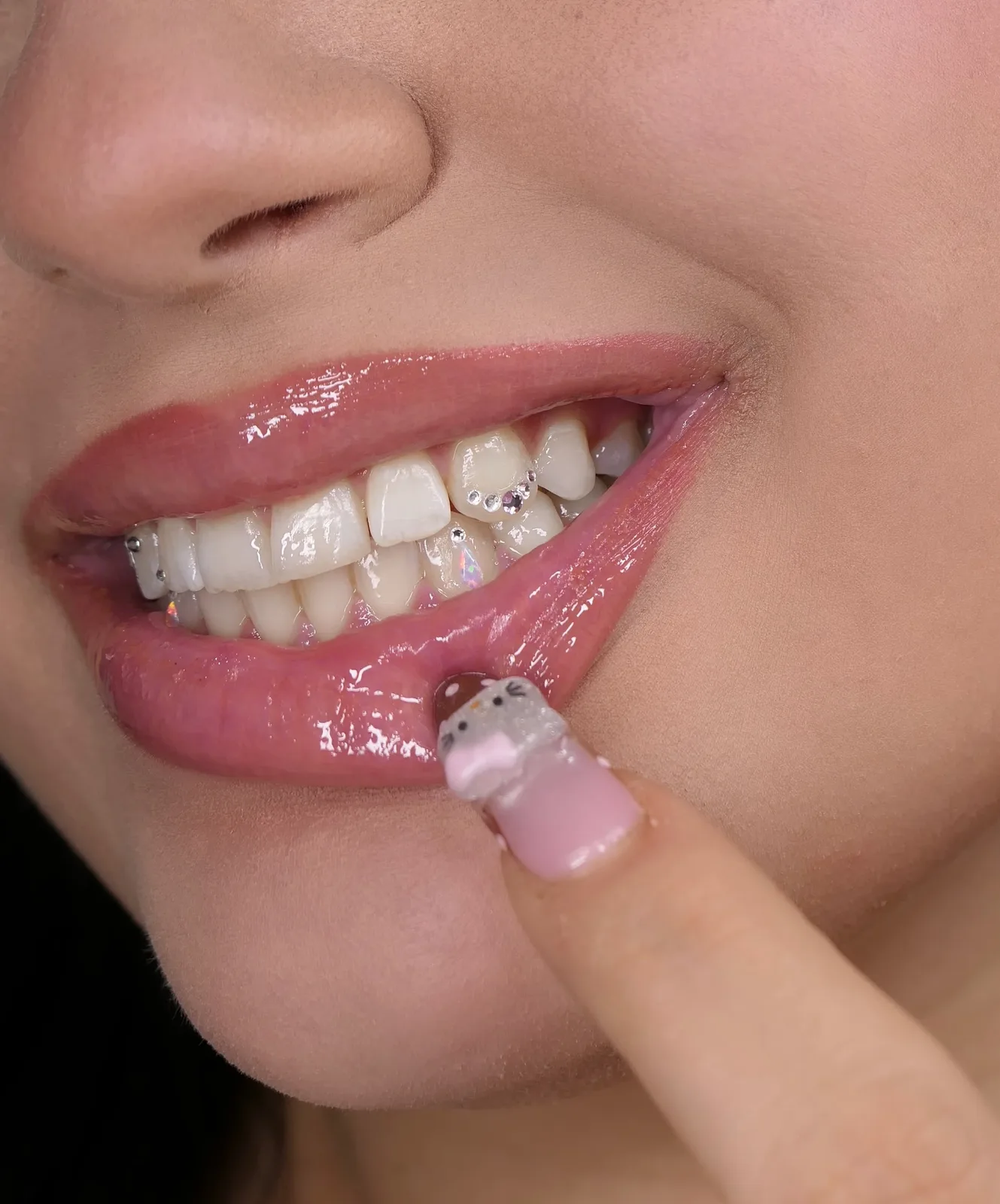 A single gem on a bright, even natural smile — the fresh base a whitening session builds.