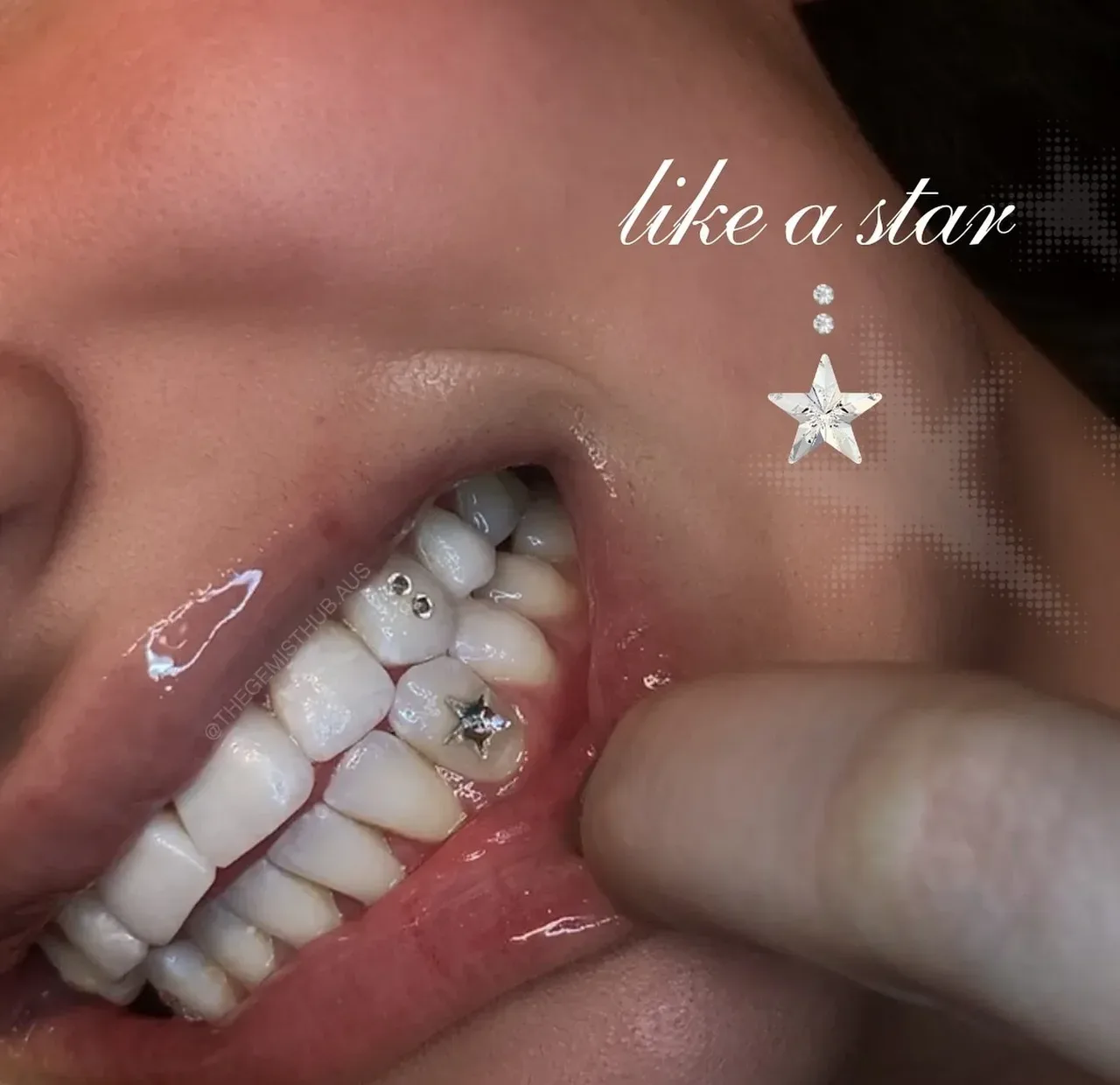 A star-shaped gem placement in close crop