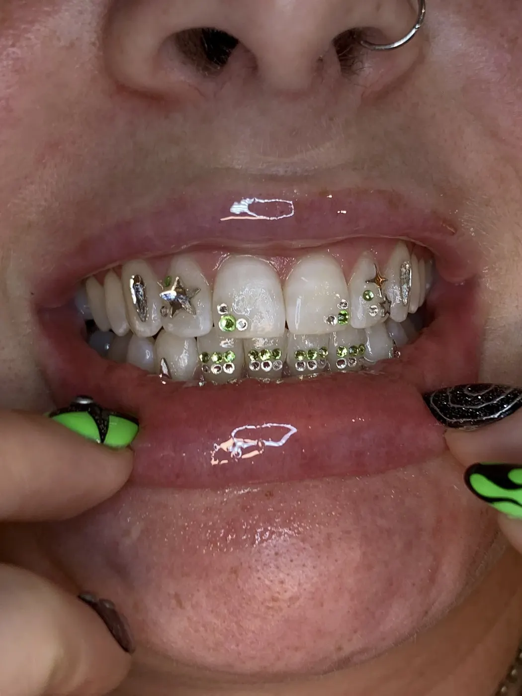 18k gold tooth charms set across a smile.