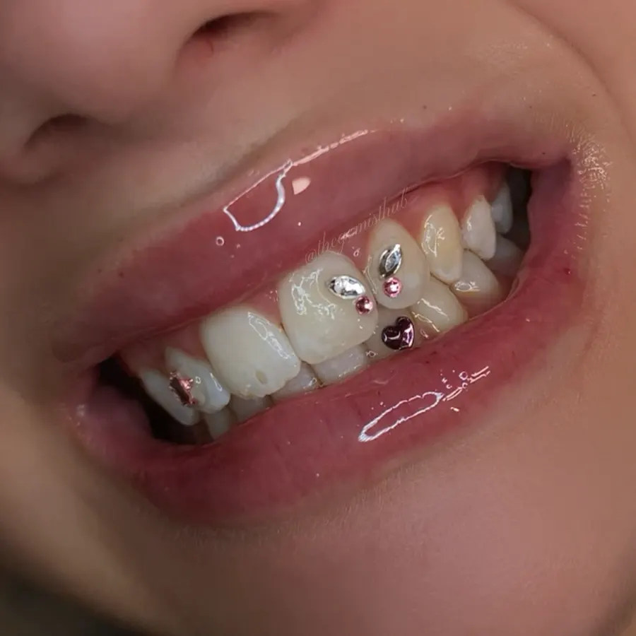 Butterfly tooth gem set