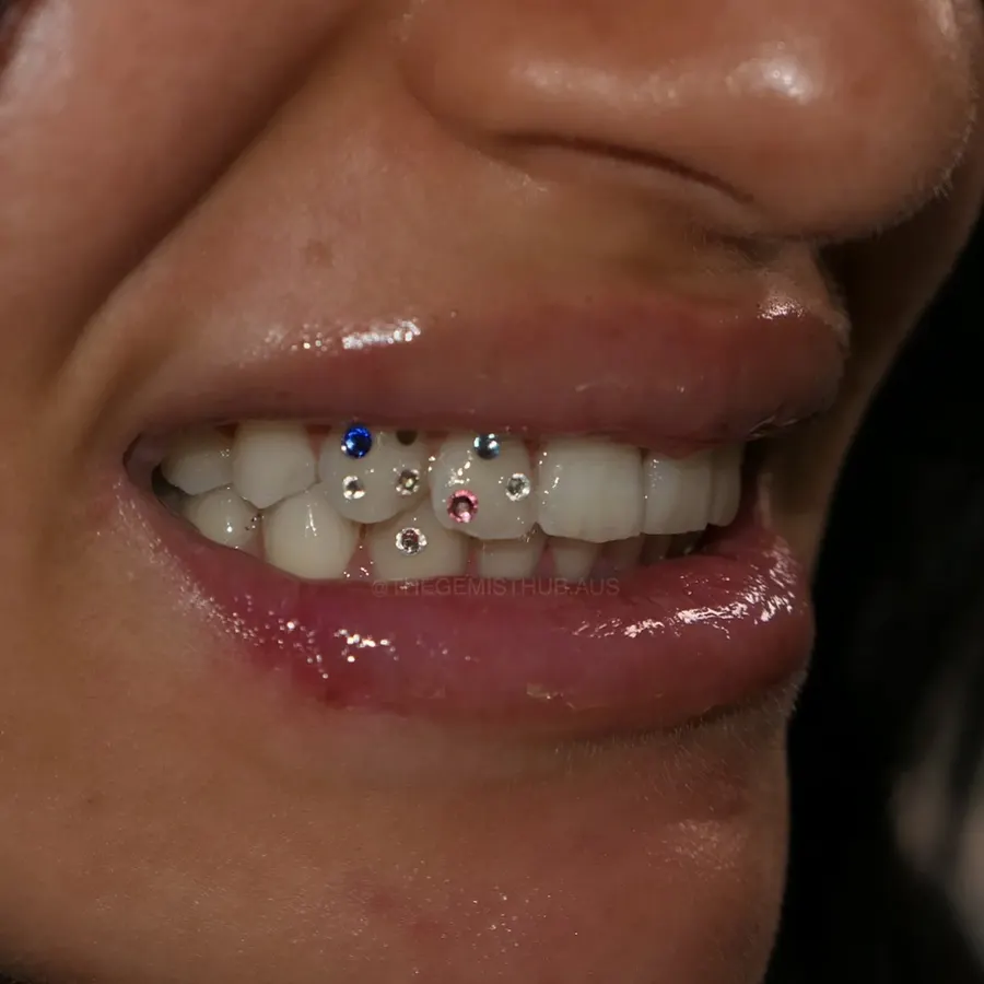 Constellation tooth gem set