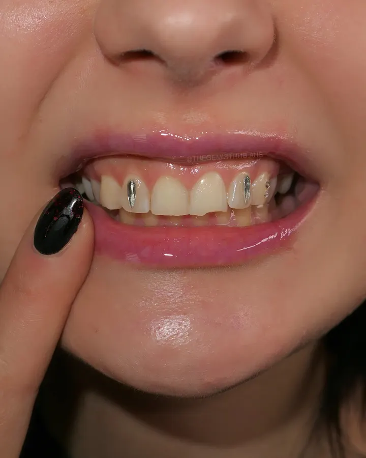 Viper / Kitty Fangs tooth gem set