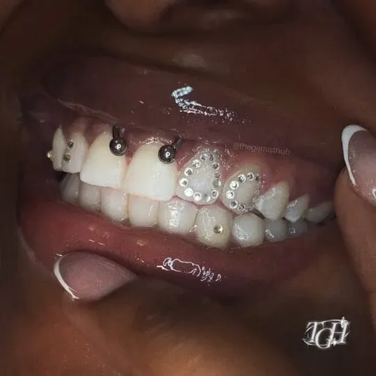 Grill Outline tooth gem set