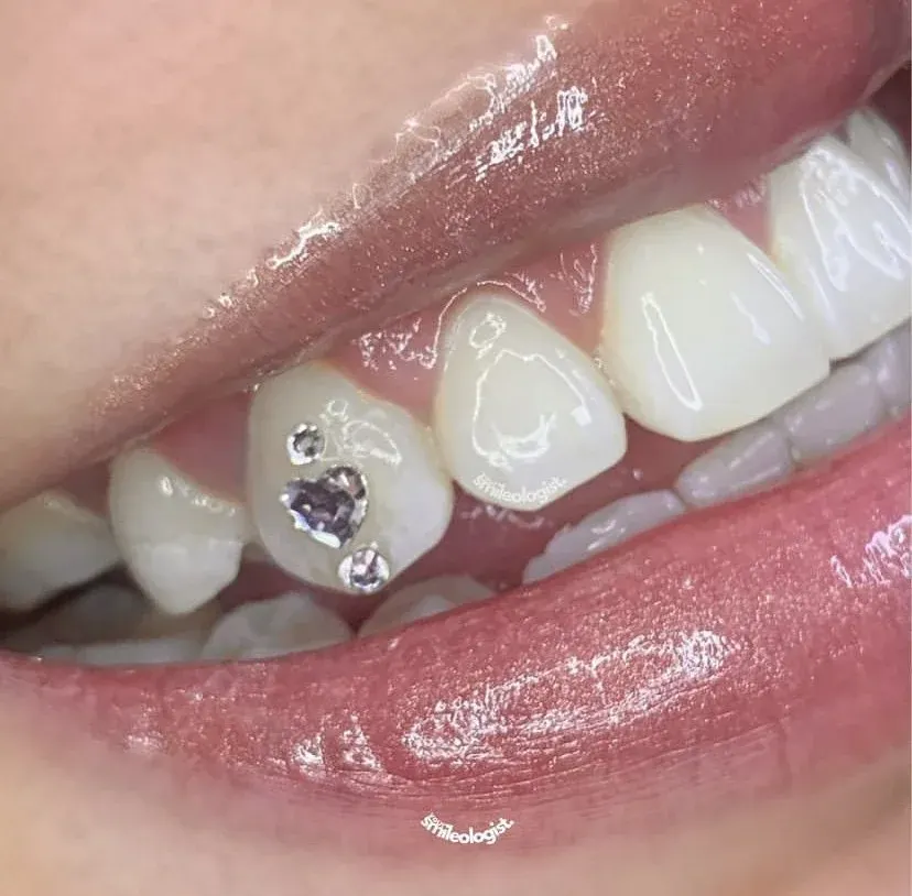 Heart Stack tooth gem set