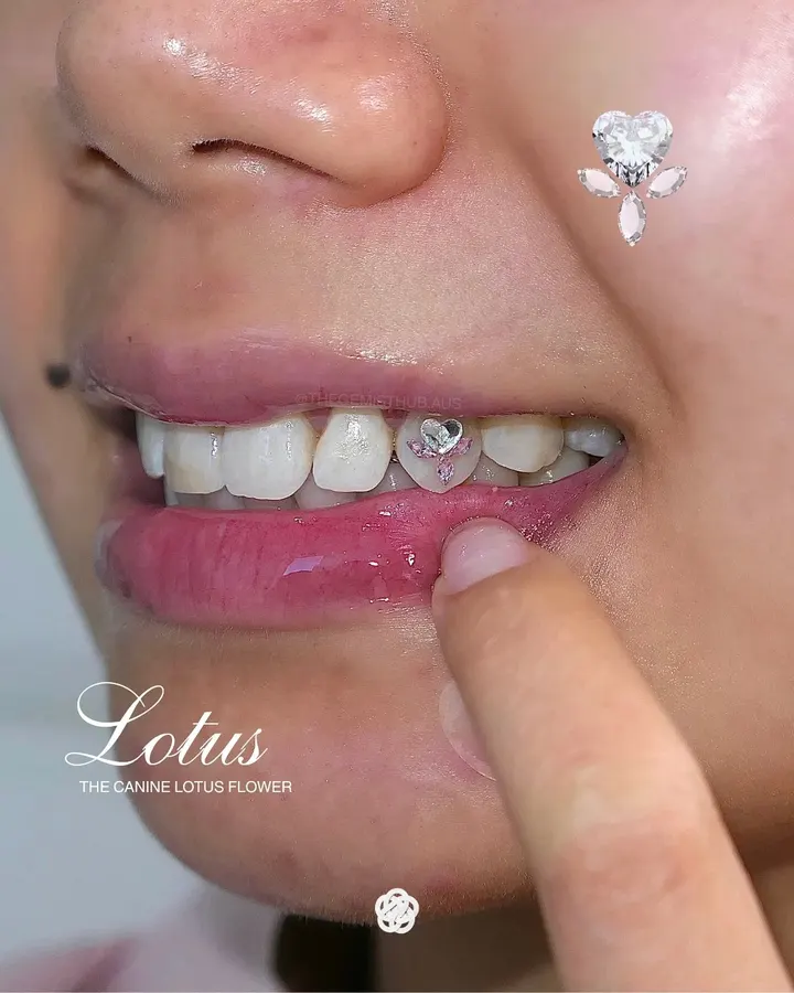Lotus tooth gem set