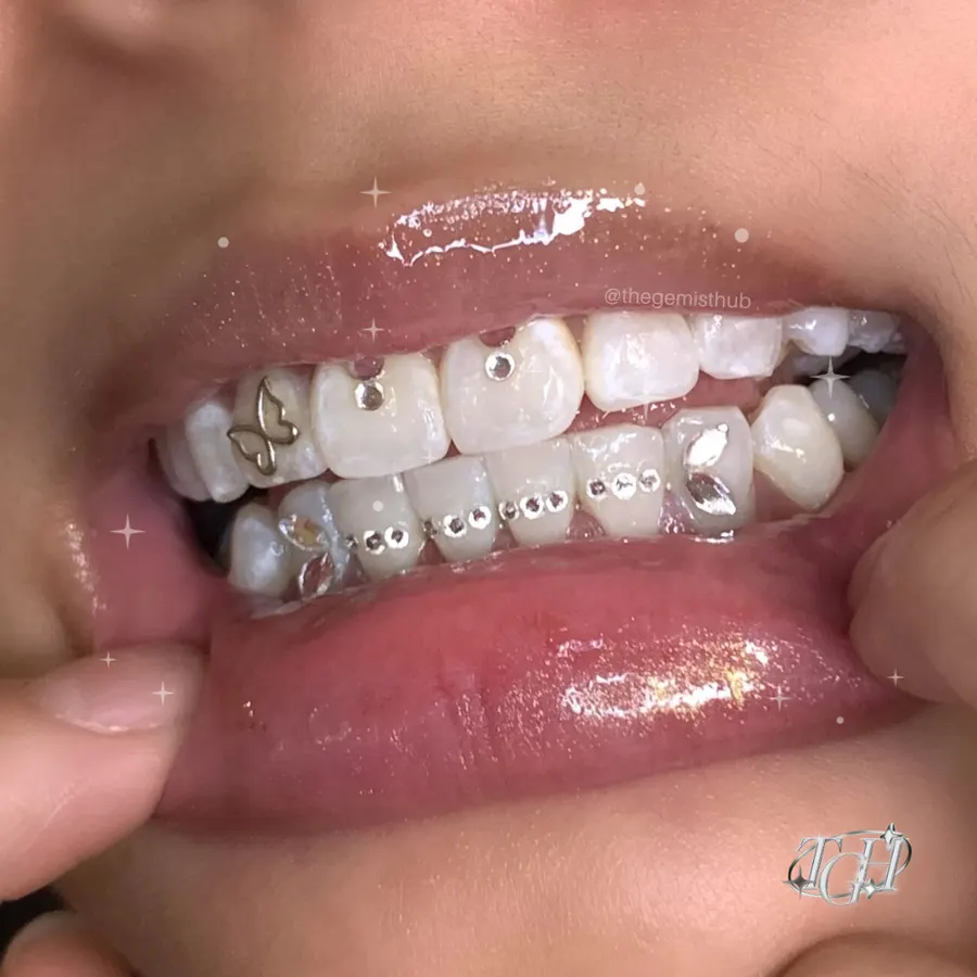 Tinkerbell Bar tooth gem set