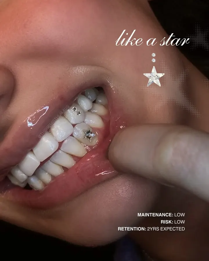 Y2K Star tooth gem set